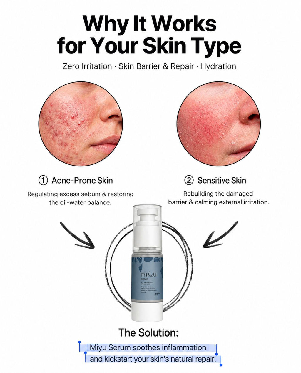 Serum